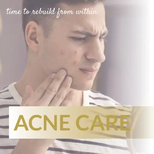 [AC16] Acne Care